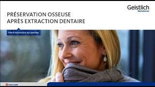 Extraction d’une dent – que faire maintenant [upl. by Essiralc448]