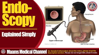 What is Endoscopy [upl. by Eiramac]