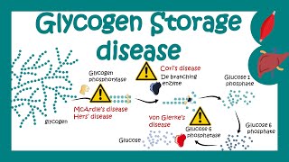 Glycogen Storage Diseases  GSD  Which glycogen storage disorder is most common  pathology of GSD [upl. by Acilegna]