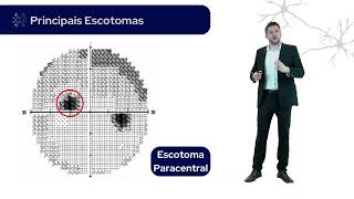 DECIFRANDO A SEMIOLOGIA NEUROLÓGICA  CURSO TEÓRICO [upl. by Kilam]