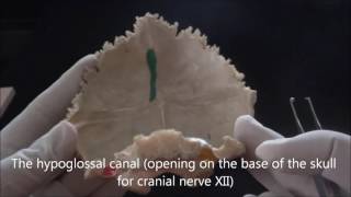 Bones of the skull  The occipital bone  Human Anatomy Video [upl. by Coben]