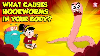 What causes Hookworm। Intestinal Worms Symptoms and Treatment  Worm Infection  Dr Binocs Show [upl. by Lombardy]