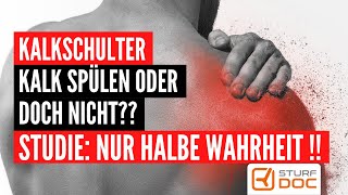 Kalkschulter  Placebo besser als Entfernung durch Spülung Diese Studie irrt schulterschmerzen [upl. by Nabois]