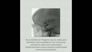 ARTERIOGRAFIA CEREBRAL DIAGNOSTICA NEUROURC Dr Cristobal Salgado [upl. by Alexi]