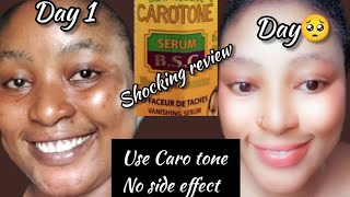 CAROTONE Serum  Shocking 😲 ReviewBrightening 🧖‍♀️Repair Soothing Oilcarotoneserum Review [upl. by Slosberg]