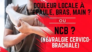 Douleur locale à lépaule bras ou main ou NCB  Névralgie CervicoBrachiale [upl. by Lauretta]