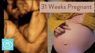 31 Weeks Pregnant What You Need To Know  Channel Mum [upl. by Alaster]