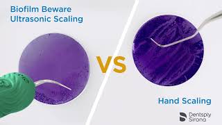 Cavitron 300 Series Ultrasonic Scaling System from Dentsply [upl. by Oirasor]