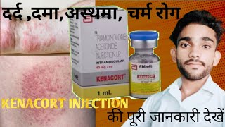 Kenacort injectionTriacinolone acetonid useside effects Does in hindi 2024 [upl. by Hardin]