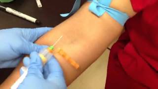 Venipuncture 13 [upl. by Cristen]