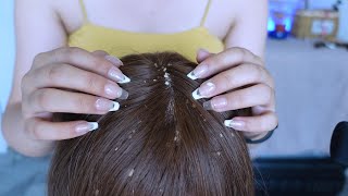 ASMR  Dandruff Removal amp Scalp Check Extremely Satisfying [upl. by Eberhard96]