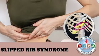 Slipped Rib Syndrome in Pediatric Patients [upl. by Ortrud392]