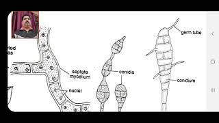 BSc 1st Exploring the Intriguing World of Alternaria Fungi [upl. by Nagear541]