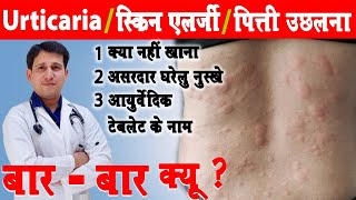 पित्ती का अचूक इलाज  शीतपित्त का उपचार  Hives  Urticaria ayurvedic Treatment  Rash  Allergy [upl. by Hcirdla]