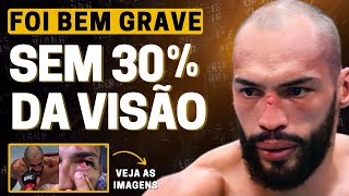 ATUALIZAÇÃO PREOCUPANTE SOBRE BRUNO BLINDADO  WEIDMAN ACEITA REVANCHE NO UFC [upl. by Eivla553]