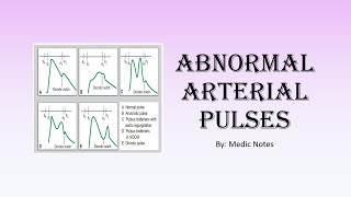 Types of arterial pulses  anacrotic bigeminal dicrotic pulsus alternans pulsus parvus et tardus [upl. by Ahsinert]