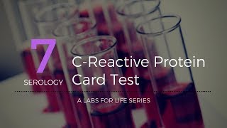 C Reactive Protein Card Test [upl. by Monie]