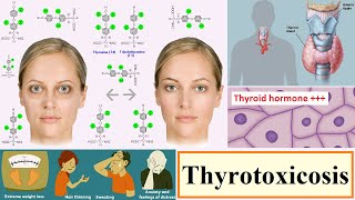 thyrotoxicosis [upl. by Pavla]