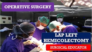 LAP LEFT HEMICOLECTOMY OPERATIVE SURGERY [upl. by Atiuqcir]