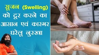 सूजन Swelling को दूर करने का आसान एवं कारगर घरेलू नुस्खा  Swami Ramdev [upl. by Htinek267]