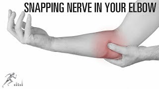 Snapping nerve in the elbow [upl. by Sivek]