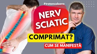 Este comprimat nervul sciatic Ce manifestări are și cum testăm în clinica DrOrestBolbocean [upl. by Wasson455]