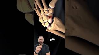 كسور العظمه الزورقيه ، scaphoid fracture surgeon anatomictherapy ترند orthopedicsurgeon [upl. by Remos]