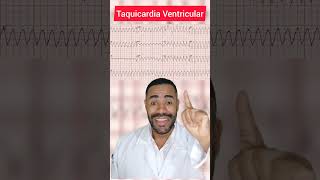 Taquicardia Ventricular ecg [upl. by Llen]