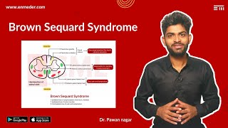 Brown Sequard Syndrome  CNS  INICET NEET PG FMGE  Dr Pawan nagar [upl. by Towney]