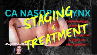 201Nasopharyngeal Carcinoma Part 33 Staging and Treatment clinicalexamination [upl. by Undry]