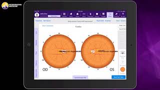 The Ophthalmology EHR System for Retina Specialists [upl. by Aihseuqram]