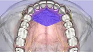 Dr Malamed local anesthesia maxillary injections [upl. by Hobard]