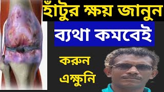 হাঁটুর ক্ষয় রুখতে ও ব্যাথা কমাতে এই কাজটি করুন Prevent Arthritis and knee Pain [upl. by Lincoln]