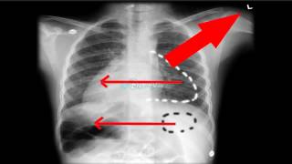 🔴 8 LES ANOMALIES A NE PAS RATER SUR RADIO THORAX  DR ASTUCE [upl. by Bechler]