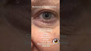 Myokymia healthtips eyecare eyediseases [upl. by Ettari]