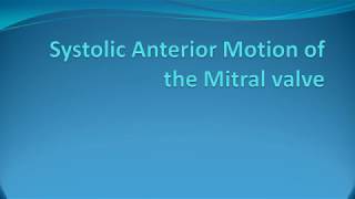 Systolic anterior motion of mitral valve  SAM Cardiac Surgery [upl. by Korwin]