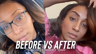 MICROSHADING VS MICROBLADING  MY EXPERIENCE amp HEALING PROCESS [upl. by Brittain679]