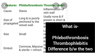 Phlebothrombosis Thrombophlebitis Pathology Second year mbbs [upl. by Adnawal701]