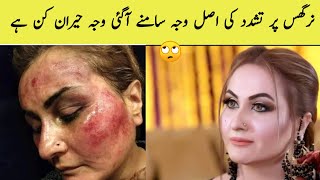 Nargis Real Story  Actress Nargis ke shohar ka bayan  تشدد کی اصل وجہ [upl. by Philan]