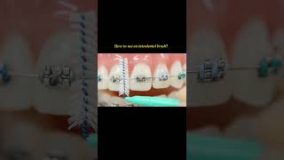 Brushes for Interdental Cleaning shortvideo shorts dental cleaning dentalcare [upl. by Hedveh]