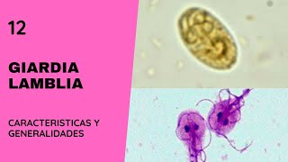 Giardia Lamblia 12  Giardiasis  Parasitología  Flagelados [upl. by Claudell83]