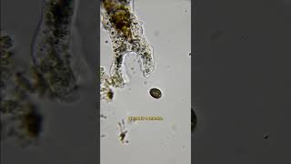 Ameba falha em capturar outro protozoário microorganismos microbiologia protozoa [upl. by Meryl184]