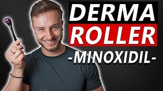 How To Use Derma Roller and Minoxidil to Regrow Hair [upl. by Courtenay199]