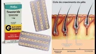 TRICOLOGIA CAPILAR  Finasterida funciona acabe de vez com a Queda de Cabelo por Rafael Secolin [upl. by Eltsirhc918]