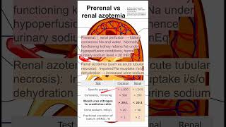 Prerenal vs renal azotemia [upl. by Anelem]