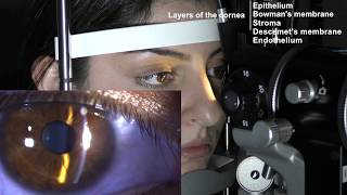 Ophthalmic Skills Series Part 15 [upl. by Luana]