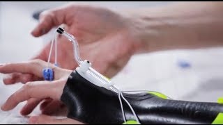 Dorsal wrist orthosis Orfilight Black with Orfitube outrigger  Splinting techniques 810 [upl. by Rosabelle]