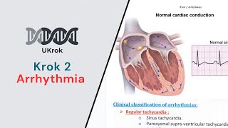 KROK 2  Arrhythmia All Types amp related NEW Krok questions [upl. by Bausch951]