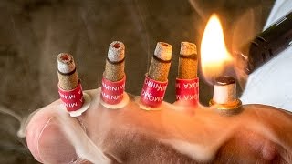 Gout Treatment Moxa Burning  Moxibustion [upl. by Ellehcsar861]