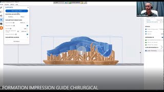 FORMATION IMPRESSION GUIDE CHIRURGICAL [upl. by Oinota]